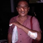 Foto: Yanto korban luka adalah anggota SatpolPP Gambiran.